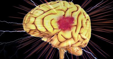 Une neurologue d'Amiens alerte sur le lien entre hypertension et AVC