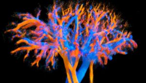 L'Inserm cartographie la circulation sanguine d'un organe entier, une première mondiale