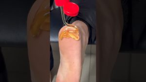 Découvrez le MIEL : le secret pour des pieds parfaits !