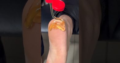 Découvrez le MIEL : le secret pour des pieds parfaits !