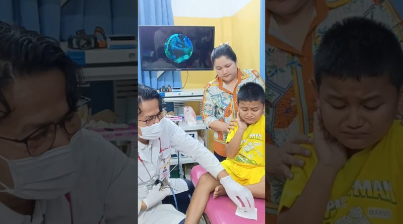 🐞 Dr. ENT Sauve un Enfant d'un Insecte dans l'Oreille ! 😲