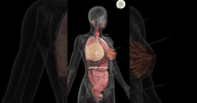 Endométriose : Le Silence Médical qui Met en Danger les Femmes