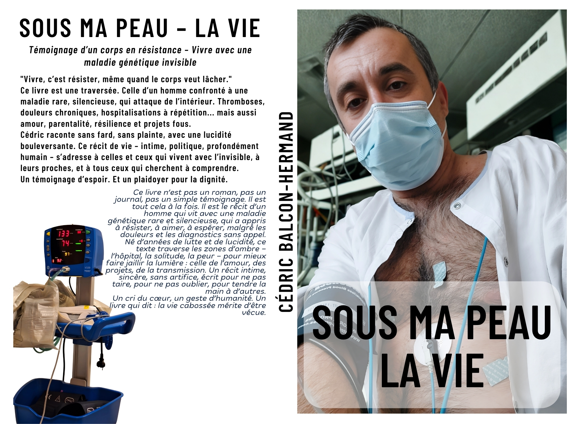 Couverture Sous ma peau – la vie