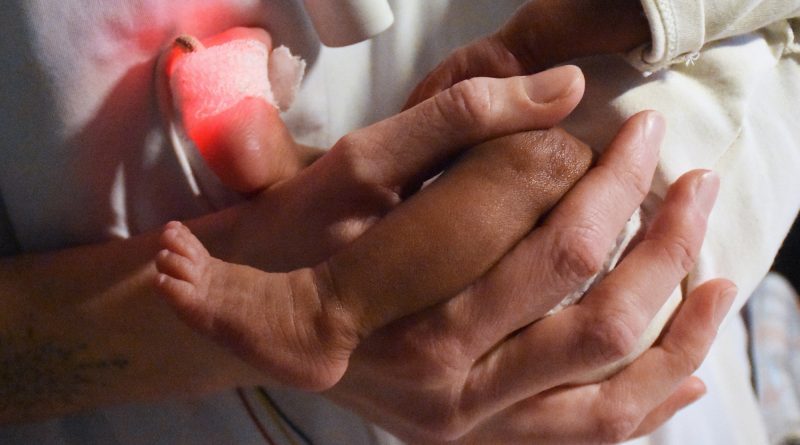 Une attention particulière portée au lien parents-enfants dès la naissance - CHU NANTES (44)