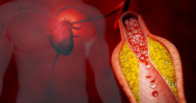 Un nouveau traitement réduit le cholestérol de près de 50 % sans statines ni effets secondaires