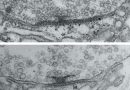 L'activité neuronale favorise la maturation des connexions pour des transmetteurs de signaux optimaux.