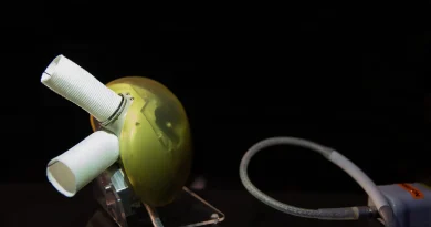 Carmat : une nouvelle proposition de reprise soumise pour l'entreprise