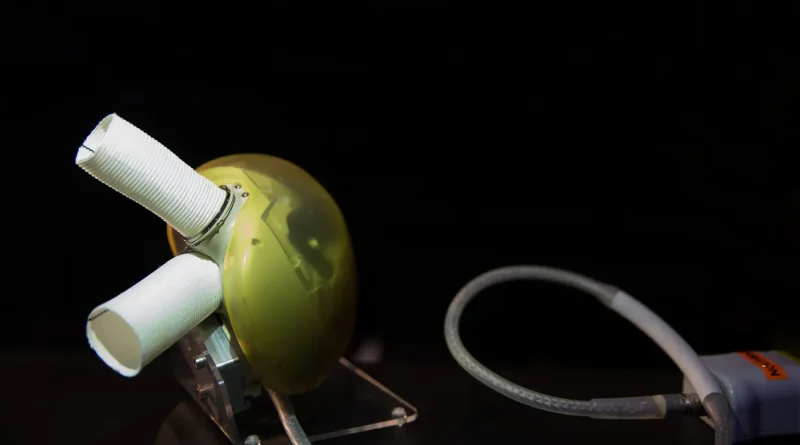 Carmat : une nouvelle proposition de reprise soumise pour l'entreprise