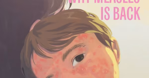 L'Alberta face à l'épidémie de rougeole au Canada