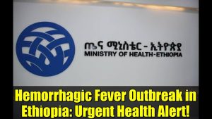 Alerte sanitaire : épidémie de fièvre hémorragique en Éthiopie