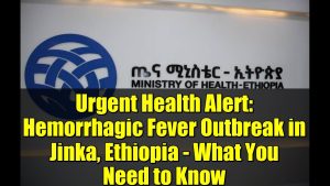 Alerte santé : Épidémie de fièvre hémorragique à Jinka, Éthiopie