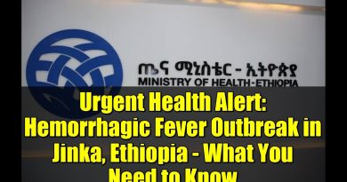 Alerte santé : Épidémie de fièvre hémorragique à Jinka, Éthiopie