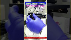 Analyse du sperme en FIV : étapes et importance