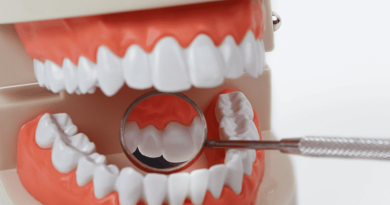 restauration dentaire