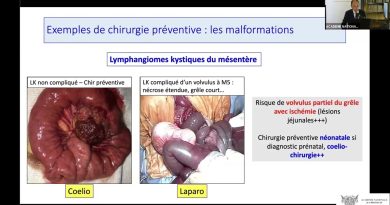 Chirurgie préventive en oncologie pédiatrique et préservation