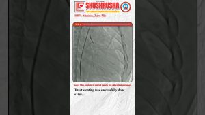 Choc cardiogénique et maladie coronarienne multivasculaire