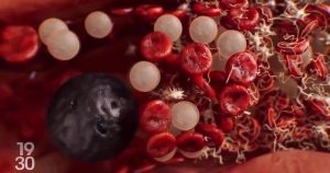 Des microrobots capables de naviguer dans les vaisseaux sanguins développés à l'EPFZ | RTS