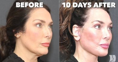 Des résultats époustouflants : guérison rapide et mâchoire bionique