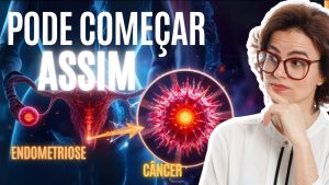 Endométriose : Risque réel de cancer à connaître !
