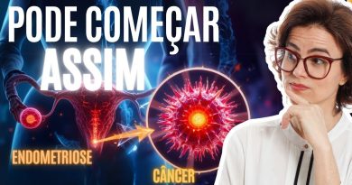 Endométriose : Risque réel de cancer à connaître !