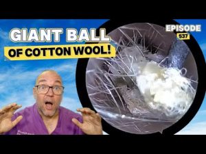 Épisode 537 : Énorme Boule de Coton !