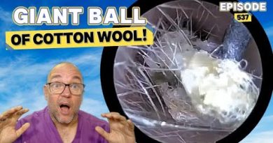 Épisode 537 : Énorme Boule de Coton !