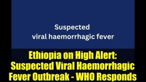 Éthiopie en alerte : soupçons de fièvre virale hémorragique