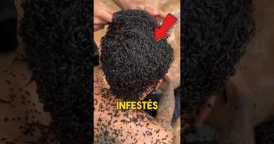 Insectes Étranges Découverts Dans Vos Cheveux !