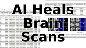 L'IA révèle des maladies cachées sur les IRM cérébrales