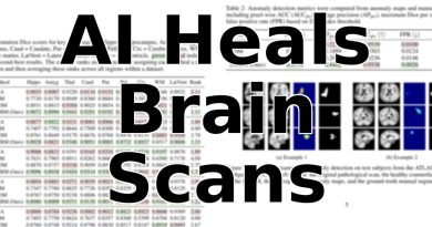 L'IA révèle des maladies cachées sur les IRM cérébrales