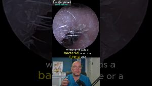 L'Infection INCROYABLE : Découvrez la vidéo complète !