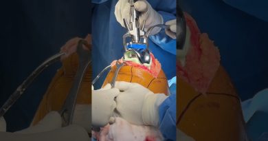 Le choix idéal : Chirurgie du genou robotisée avec Dr. Walecha