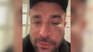 L’humoriste Anthony Joubert agressé dans un train avant un spectacle dans l’Oise