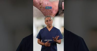 Maladie Vasculaire Périphérique | #MCAShorts