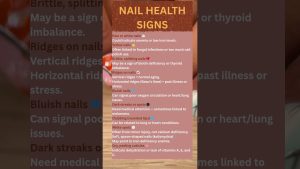 💅 Que révèlent vos ongles sur votre santé ? 🩺✨