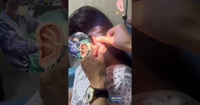 Retrait de Kéloïdes de l'Oreille : Résultats Étonnants ! 💉