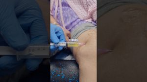 Soulager la douleur au genou : conseils pratiques et efficaces