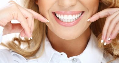 Invisalign sourire