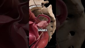 Tout savoir sur le syndrome SOPK : conseils et bien-être !