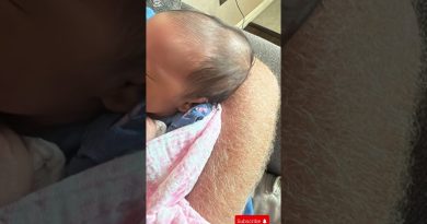 Un nouveau-né présente un céphalhématome : explications