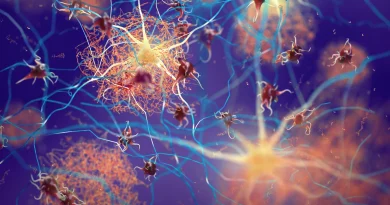 Des scientifiques font fondre des amas protéiques précoces et stoppent les dégâts d'Alzheimer.