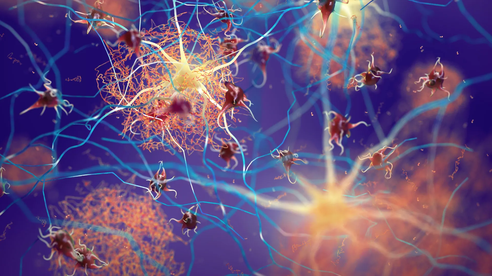 Des scientifiques font fondre des amas protéiques précoces et stoppent les dégâts d'Alzheimer.