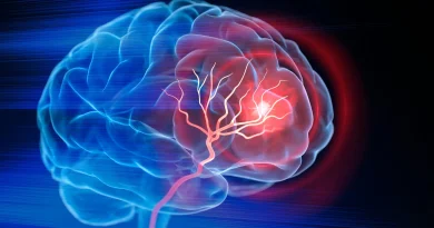 Des lésions cérébrales détectées avant l'augmentation de la pression artérielle