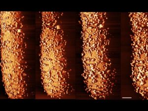 Bactérie Escherichia coli