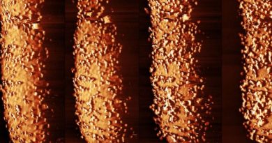 Bactérie Escherichia coli