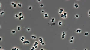 La NASA aurait envoyé sur Mars un microbe résistant à toutes les méthodes de destruction
