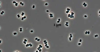 La NASA aurait envoyé sur Mars un microbe résistant à toutes les méthodes de destruction