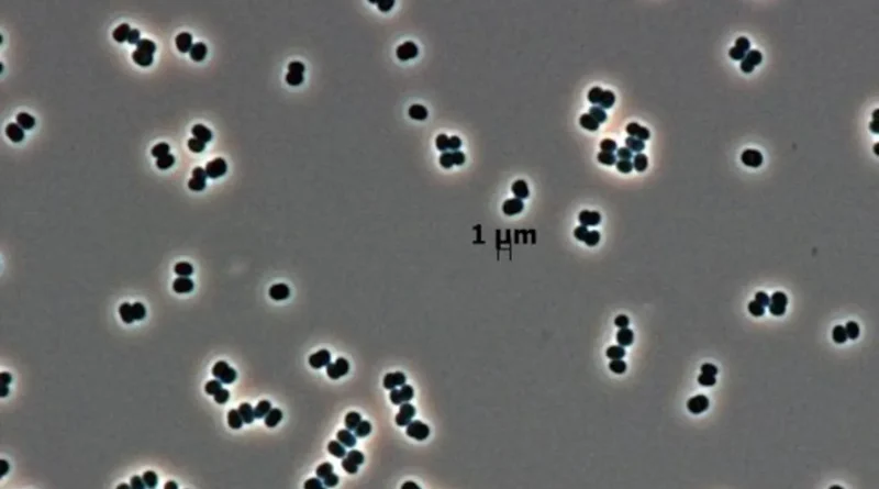 La NASA aurait envoyé sur Mars un microbe résistant à toutes les méthodes de destruction
