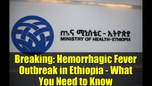 Urgent : Épidémie de fièvre hémorragique en Éthiopie - Infos clés