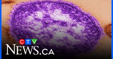 Le Canada perd son statut d'élimination de la rougeole